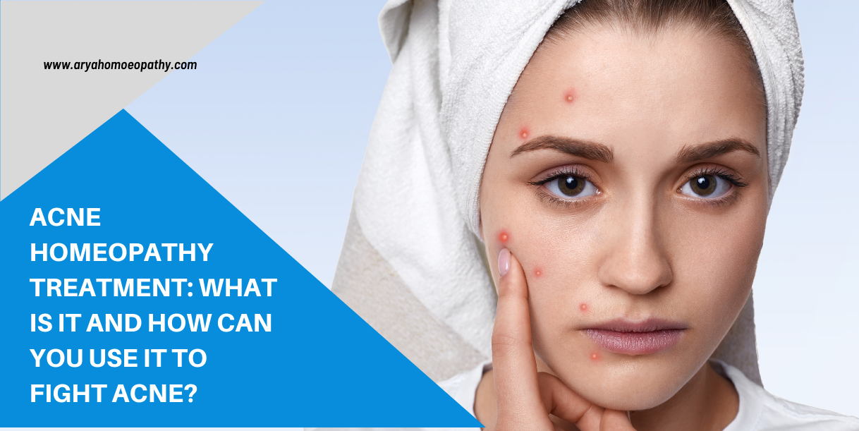Acne Homeopathy Treatment What Is It And How Can You Use It To Fight Acne
