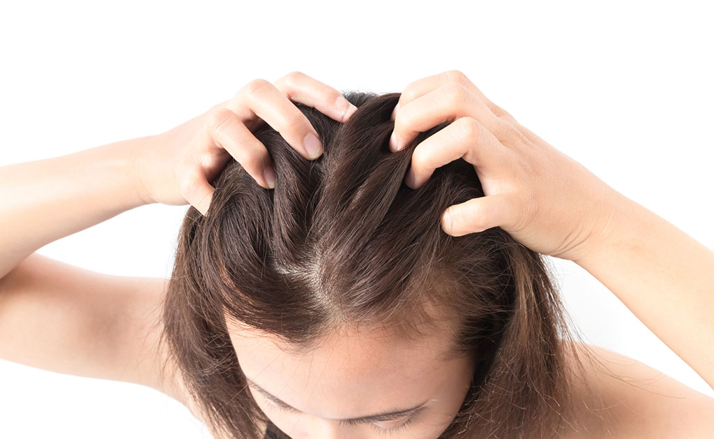 hair loss front of head female